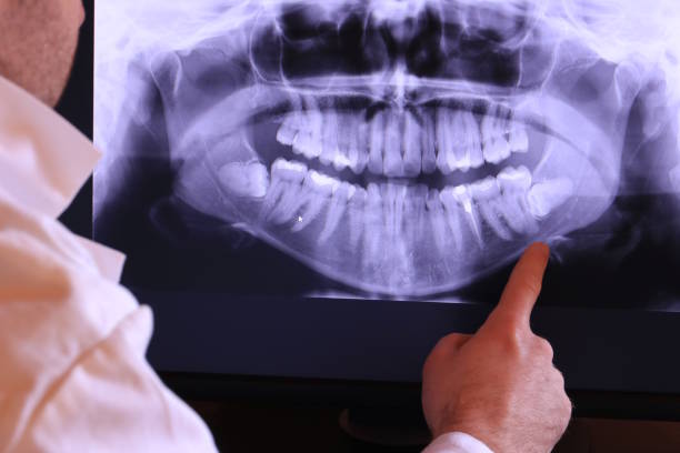 Best Emergency TMJ Treatment in Vla Grove, IL