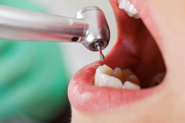 Best Emergency Dental Care for Broken or Chipped Teeth in Vla Grove, IL